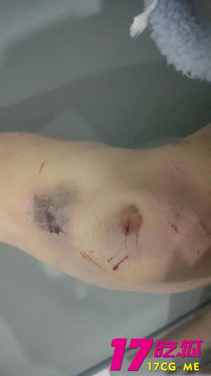 photo_9_2025-11-18_20-28-46_副本.jpg photo_9_2025-11-18_20-28-46_副本.jpg